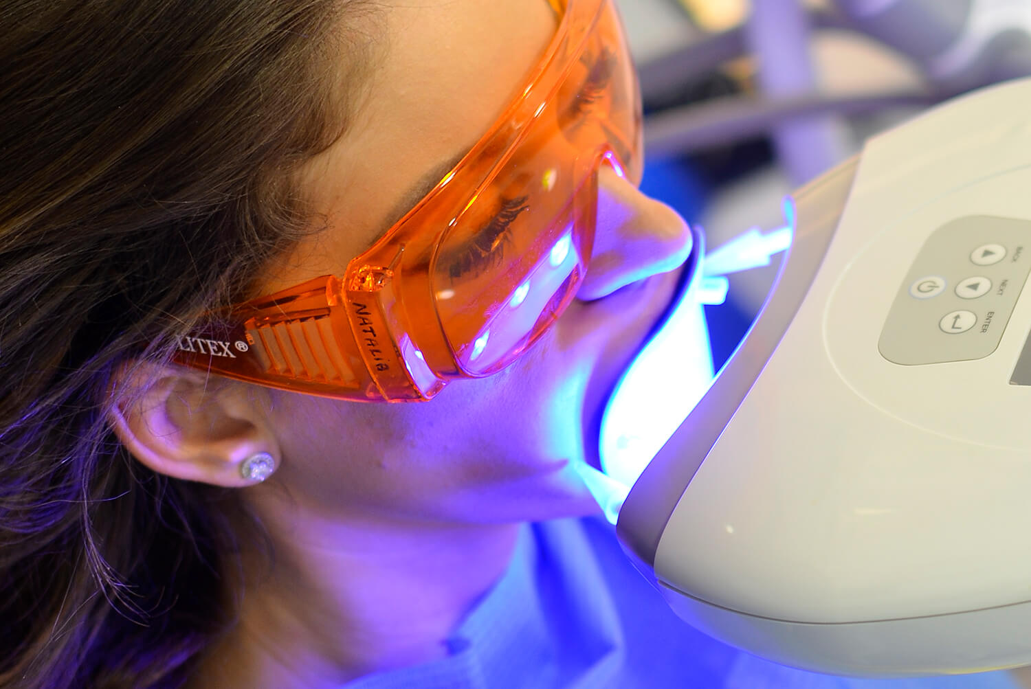 Blanqueamiento con lámapara de luz fría o led