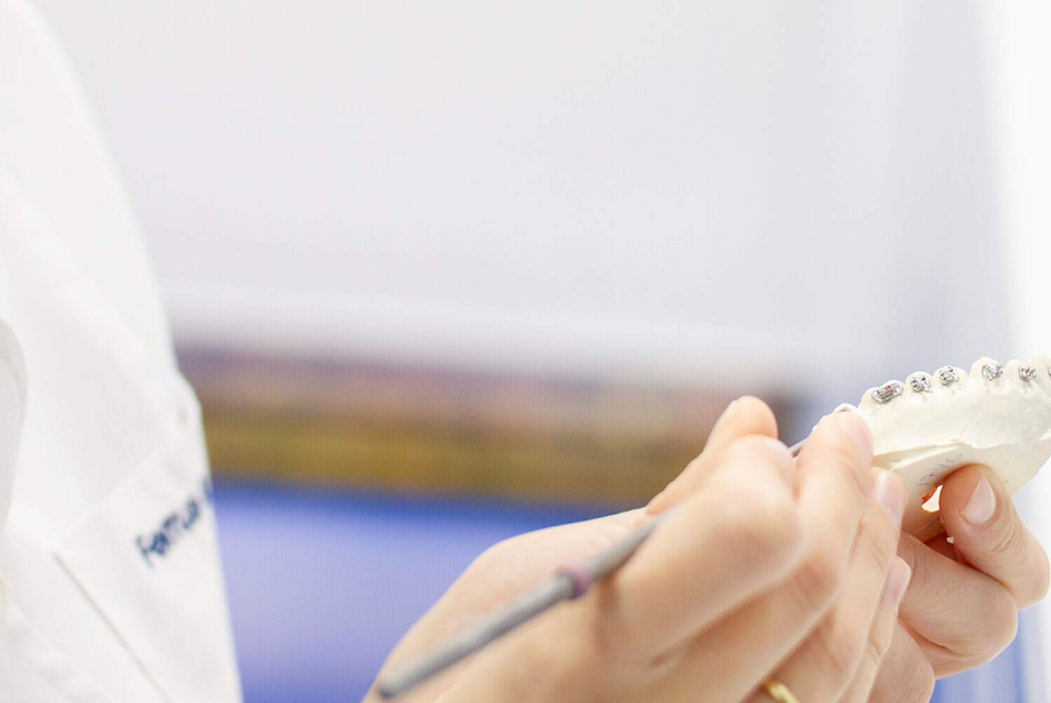 colocación de brackets metálicos