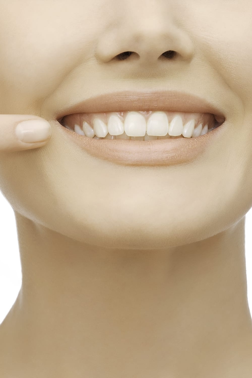 Famosos antes y después de implantes dentales