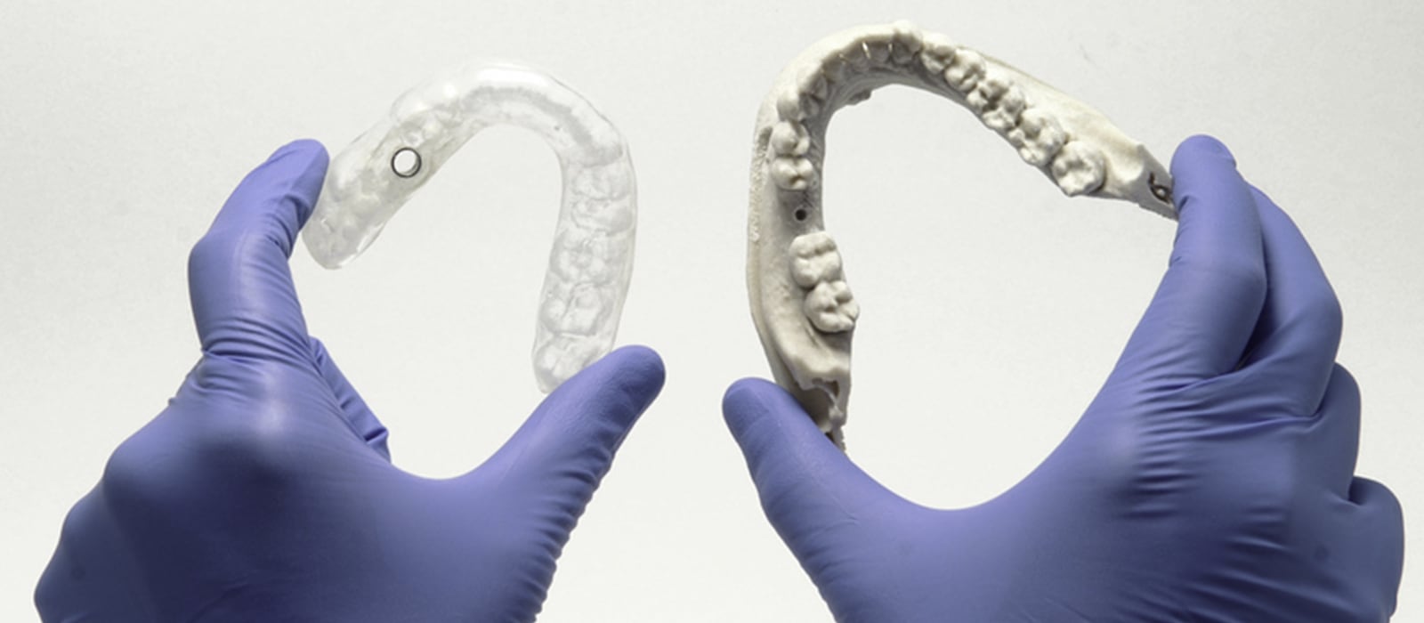 Colocación de implantes por ordenador