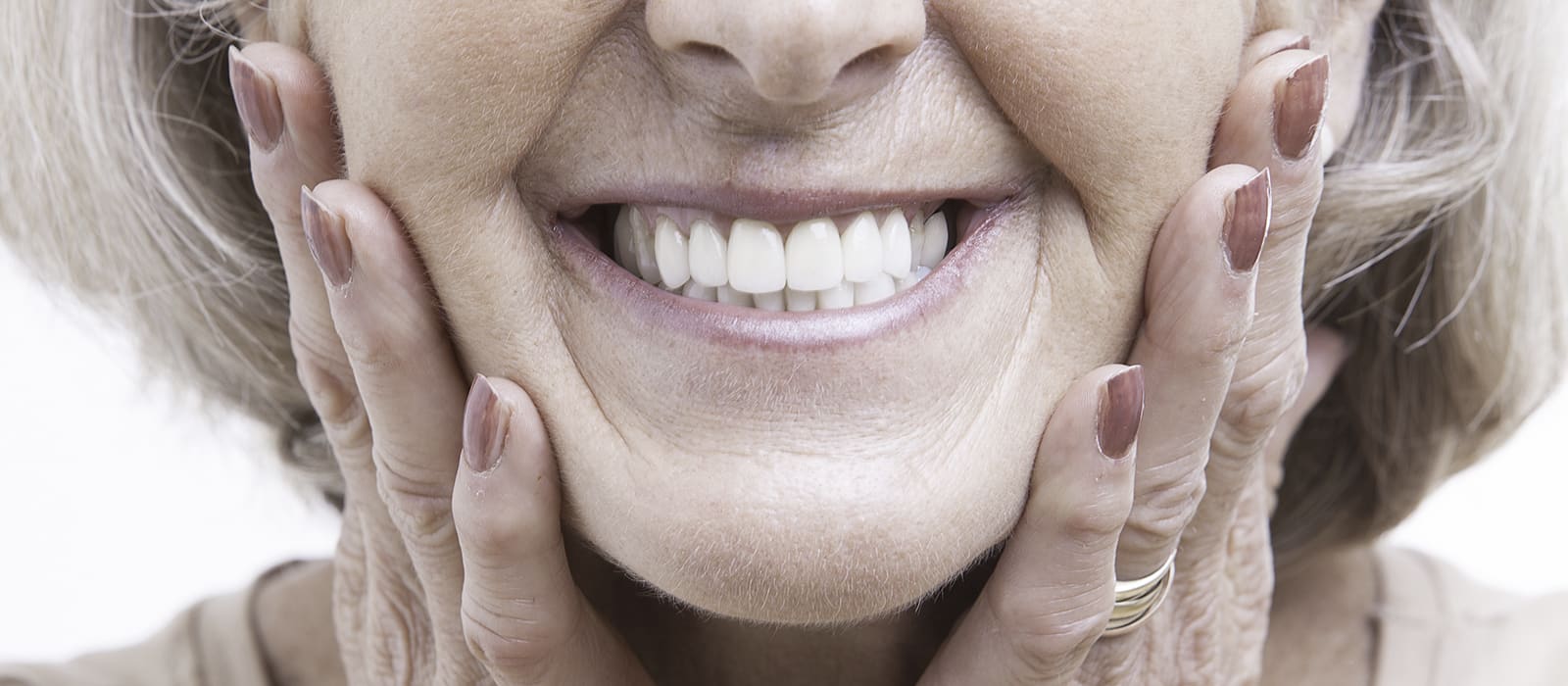 Resultado del tratamiento con implantes dentales