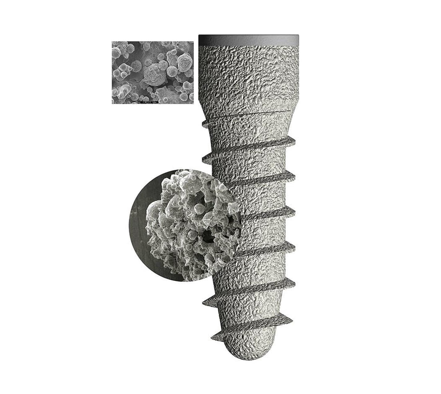 Beneficios de los implantes dentales
