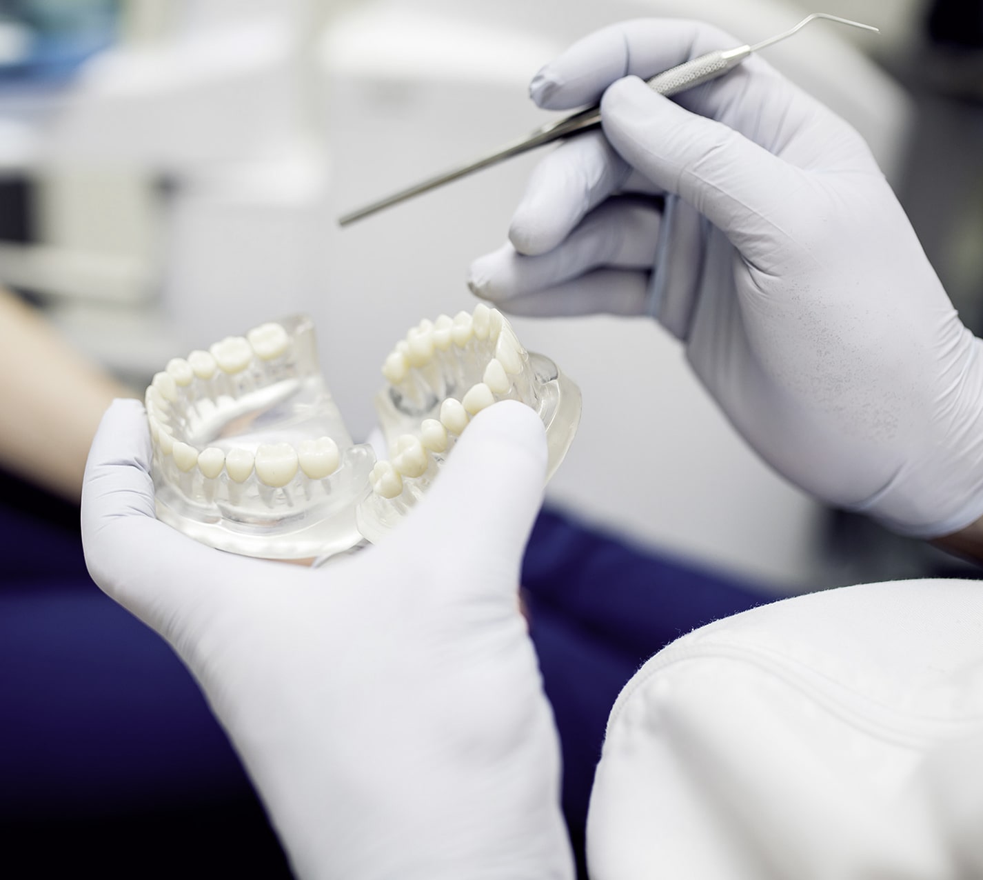 ¿Cómo se fabrican los implantes dentales paso a paso?