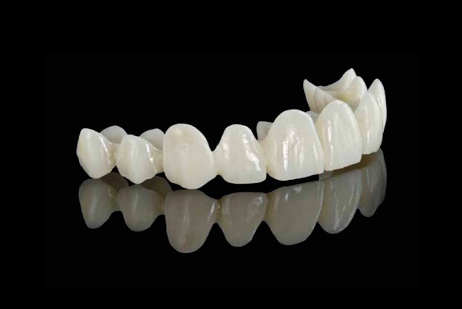 Prótesis fija sobre implantes