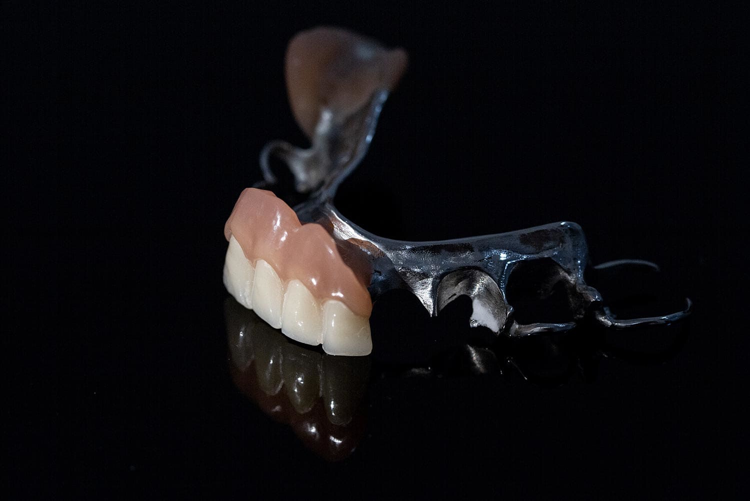 Prótesis dental removible