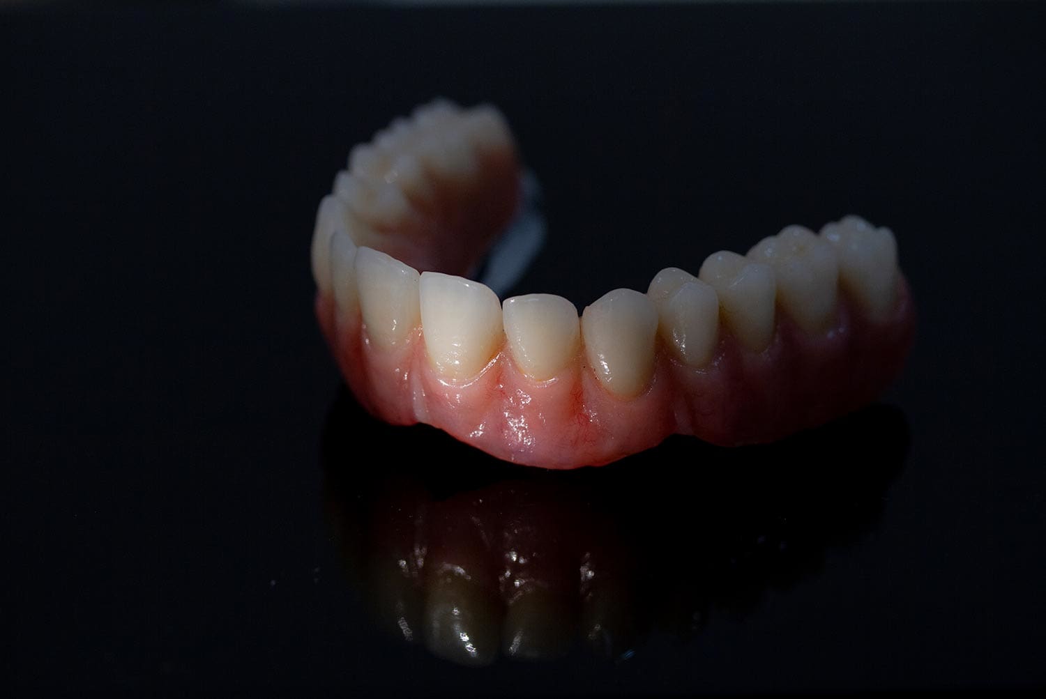 Prótesis dental semifija