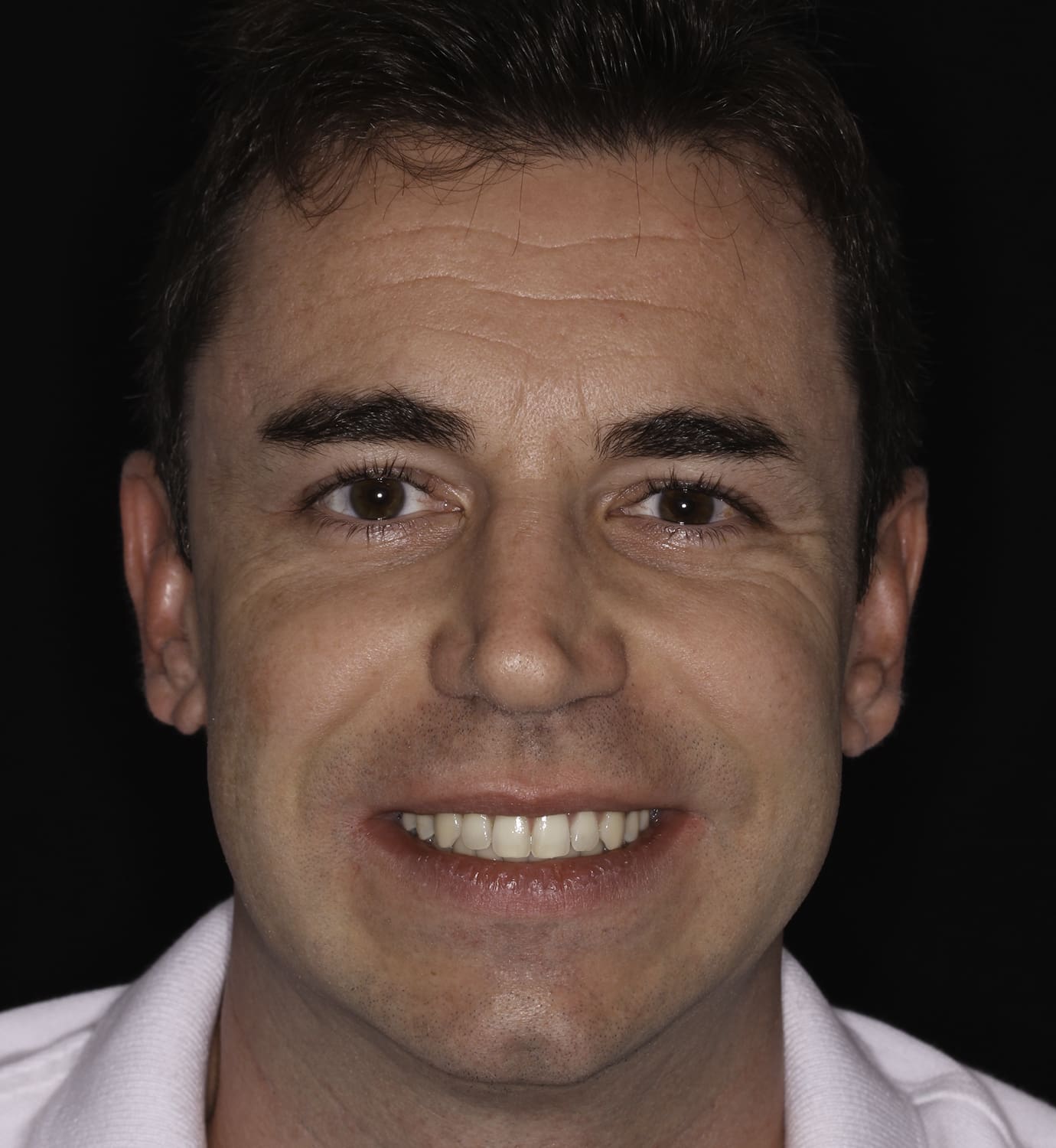 fotografía de sonrisa después tratamiento de ortodoncia