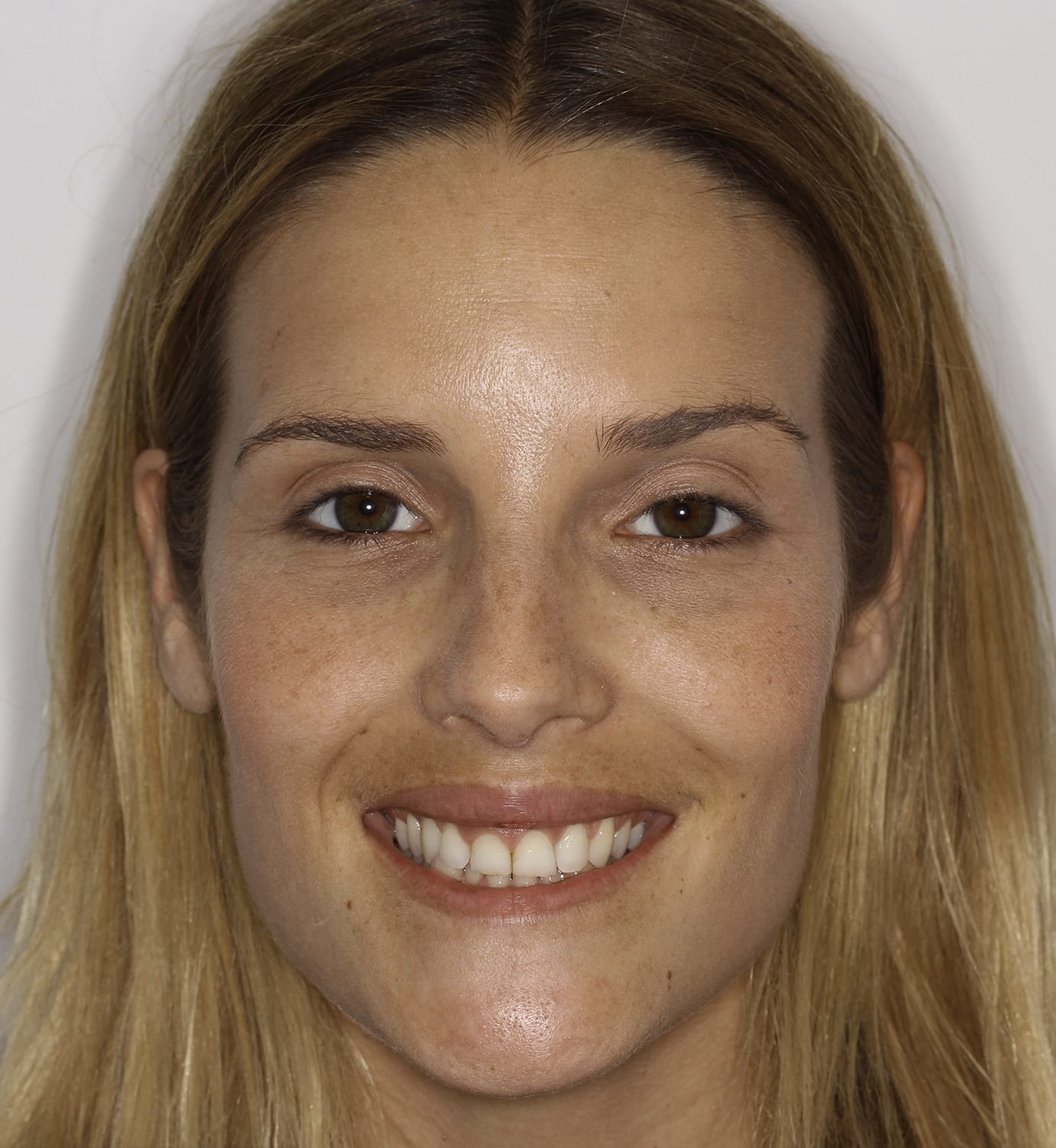 fotografía de antes