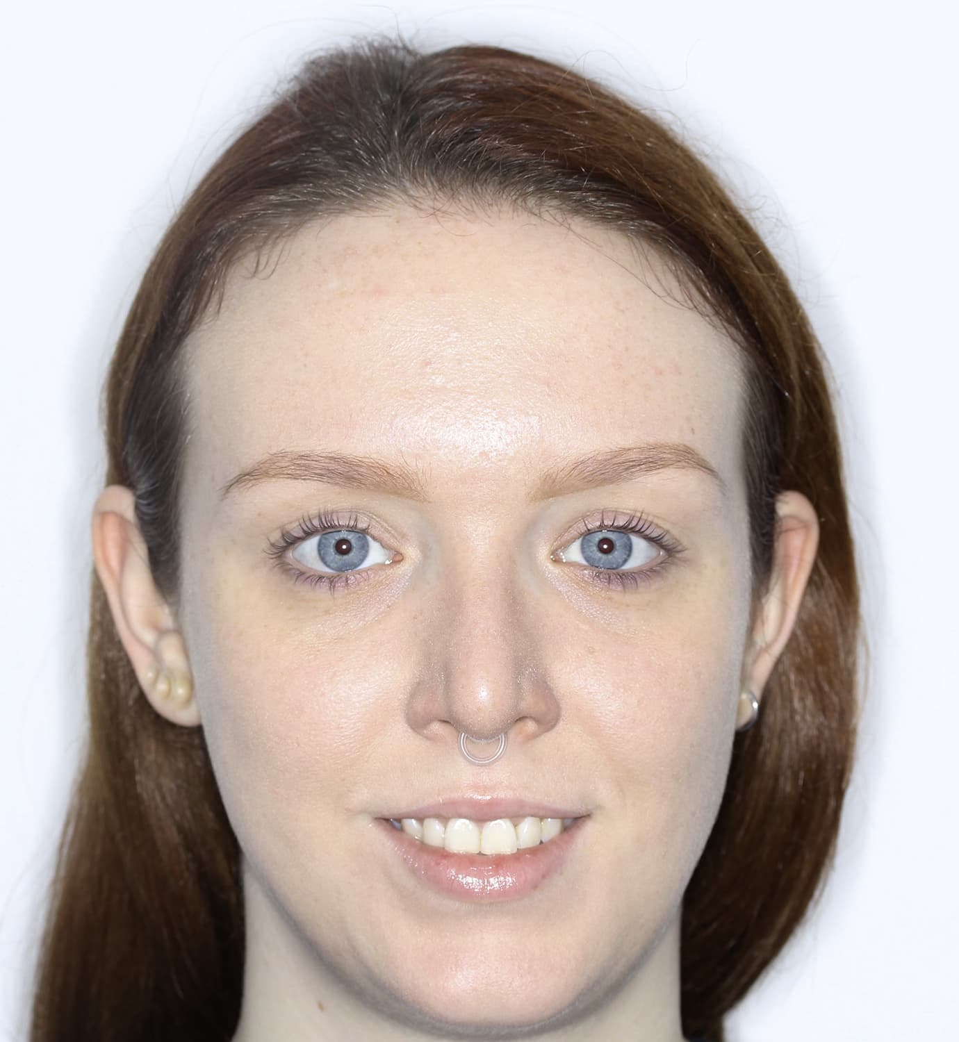 fotografía de antes