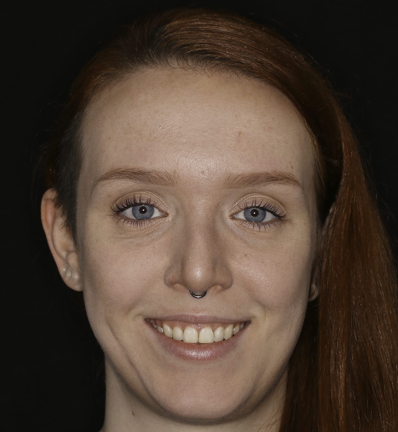 fotografía de después