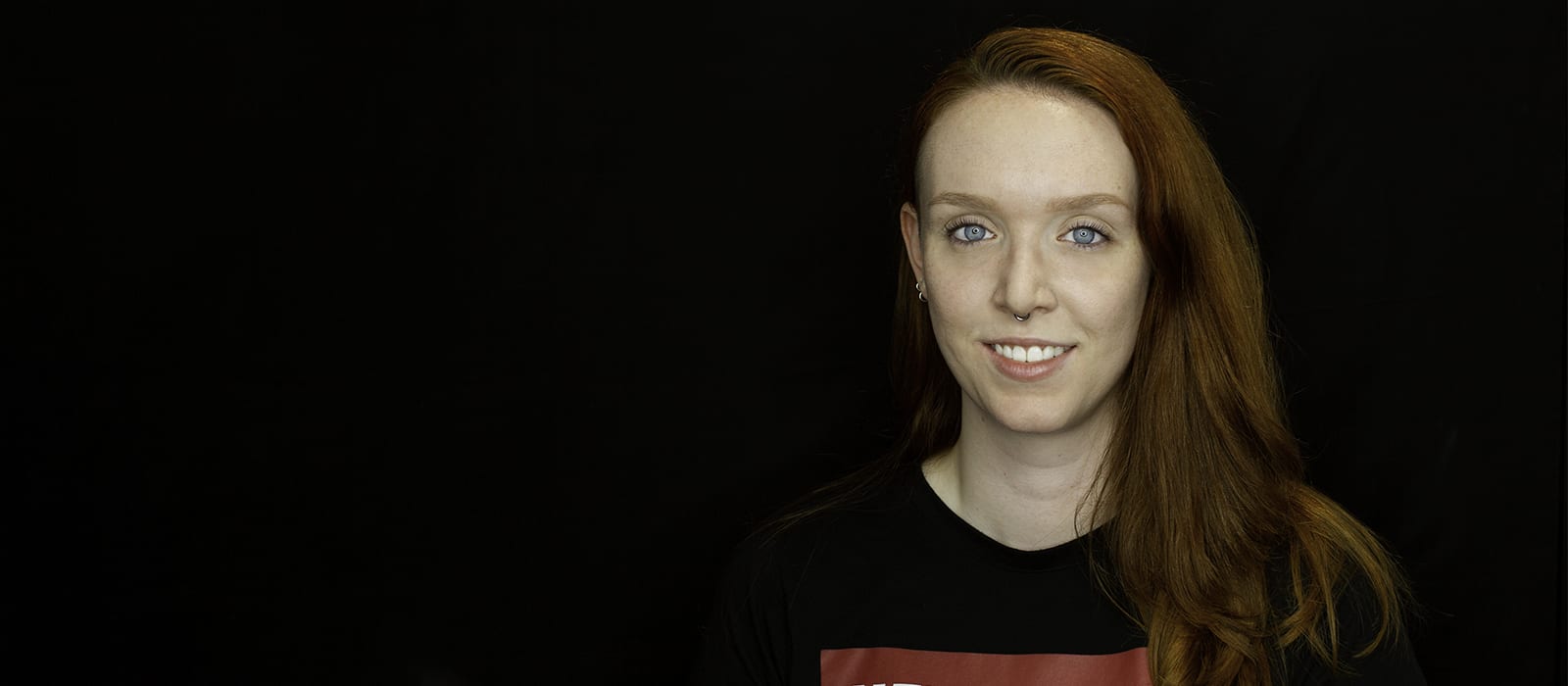 Experiencia de ortodoncia con Invisalign e implante dental unitario