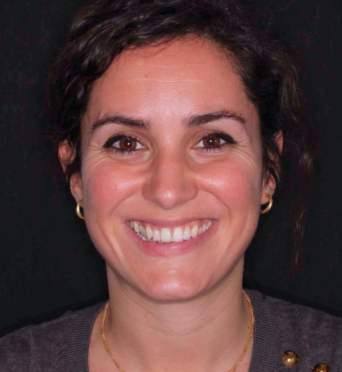 fotografía de antes