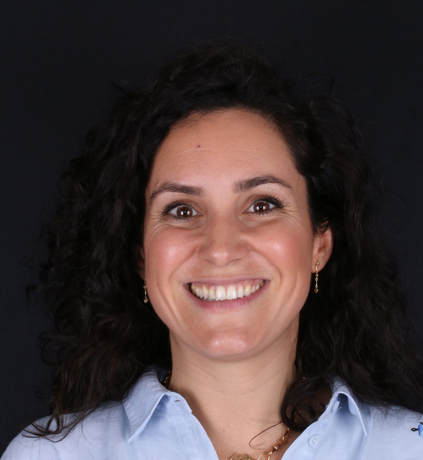 fotografía de después