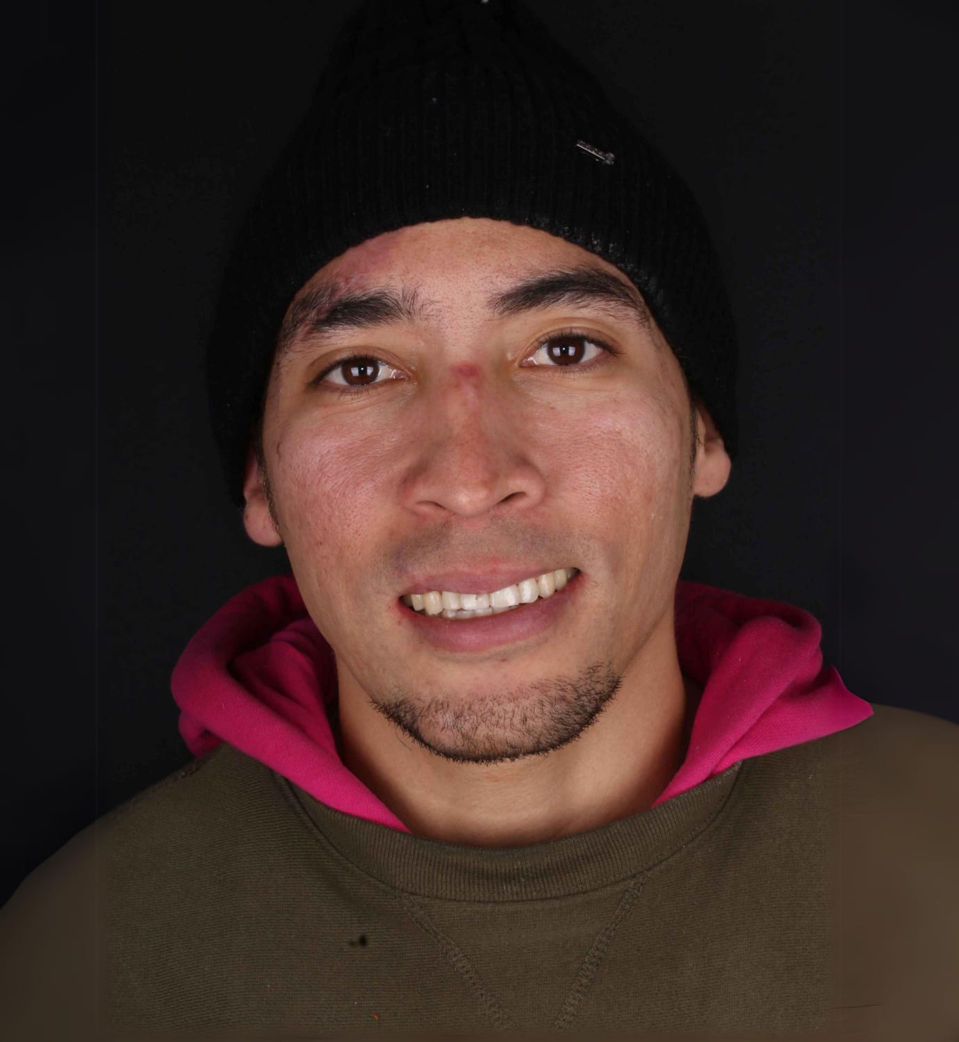 fotografía de después