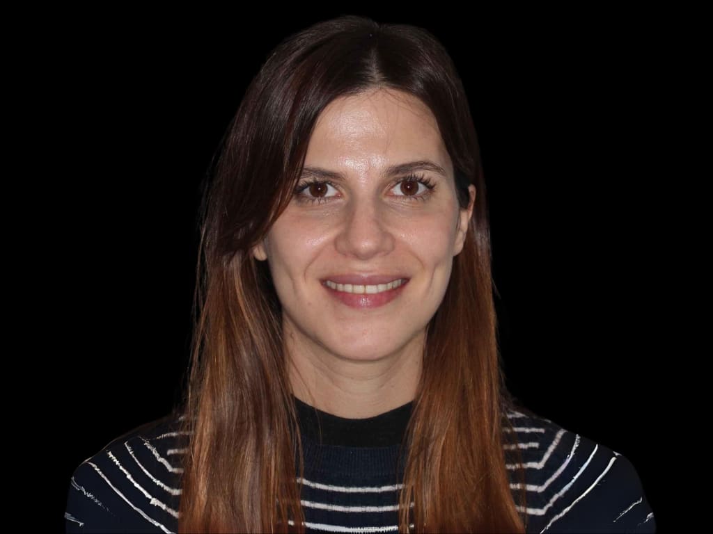 Caso antes y después de sonrisa perfecta con ortodoncia invisible Madrid