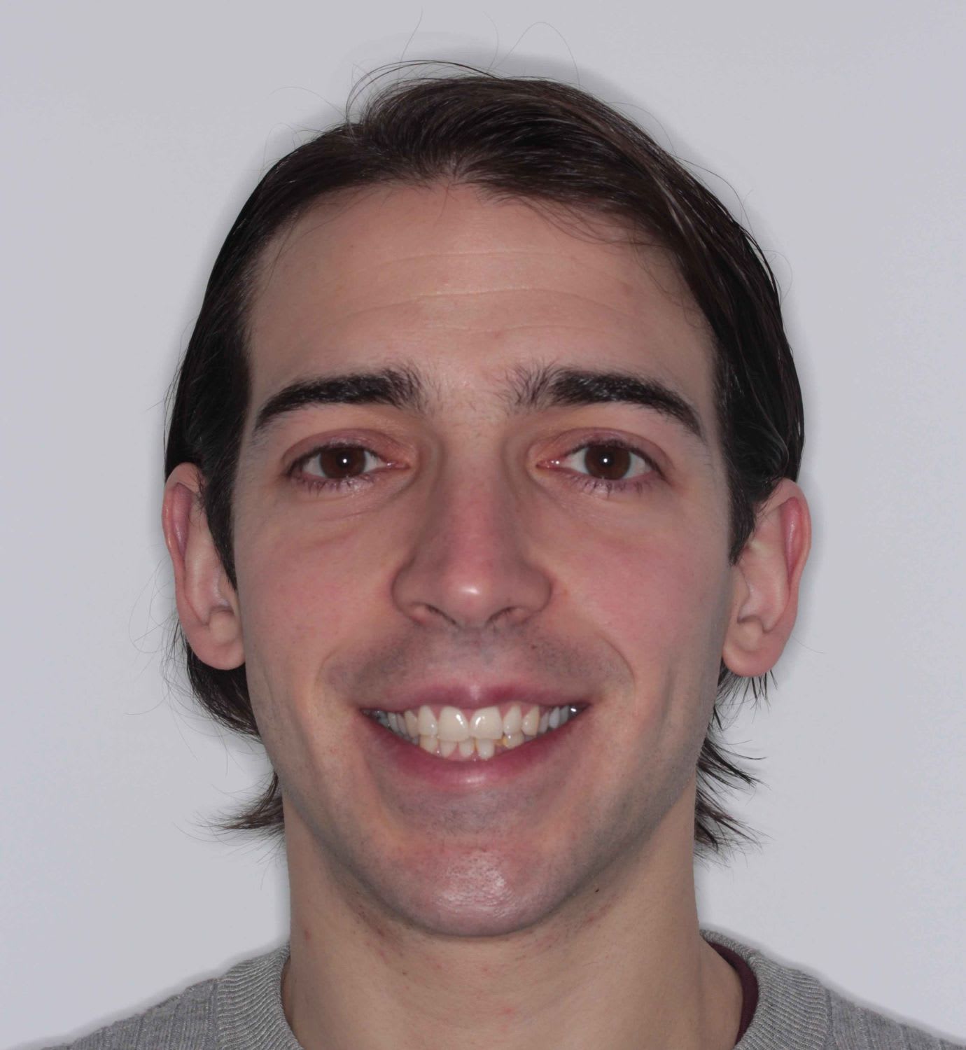 fotografía de antes