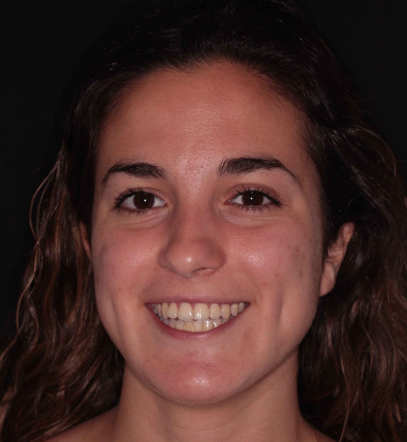 fotografía de antes