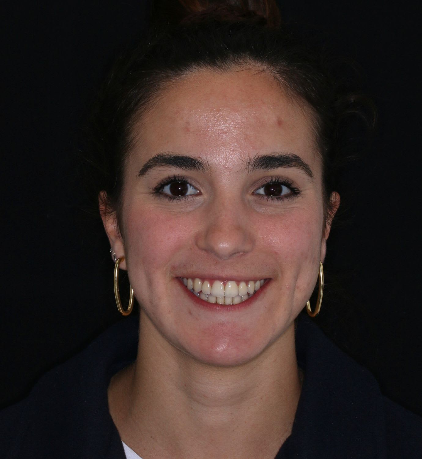 fotografía de después