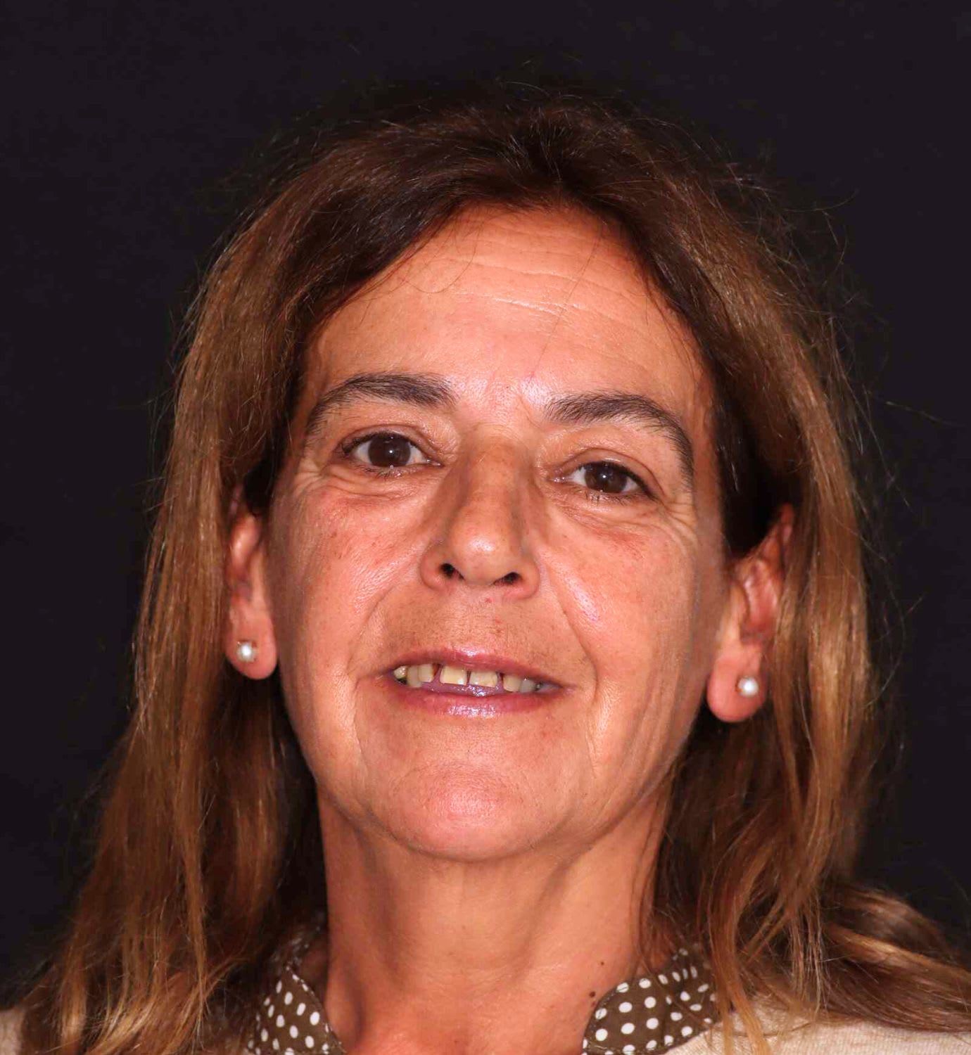 fotografía de antes