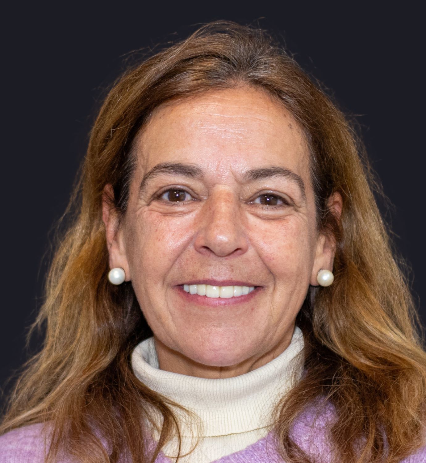 fotografía de después