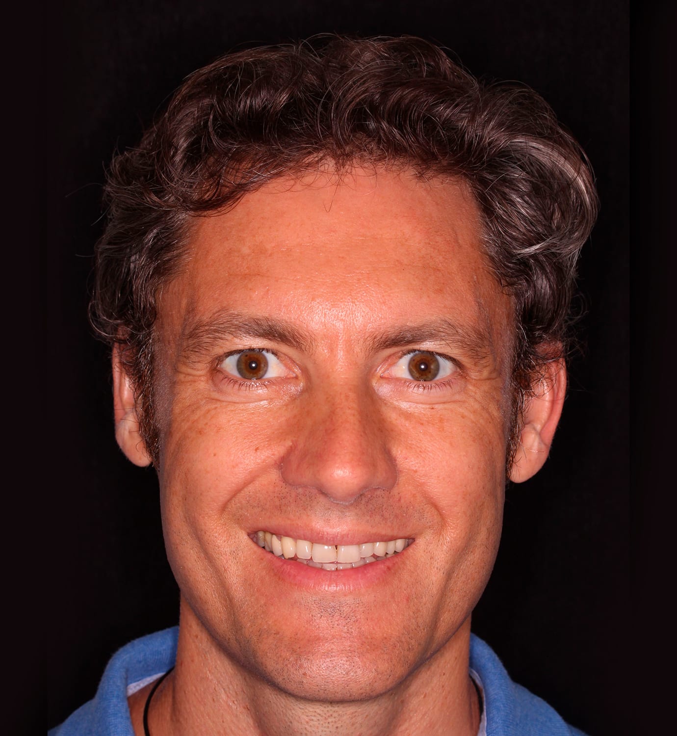 fotografía de antes