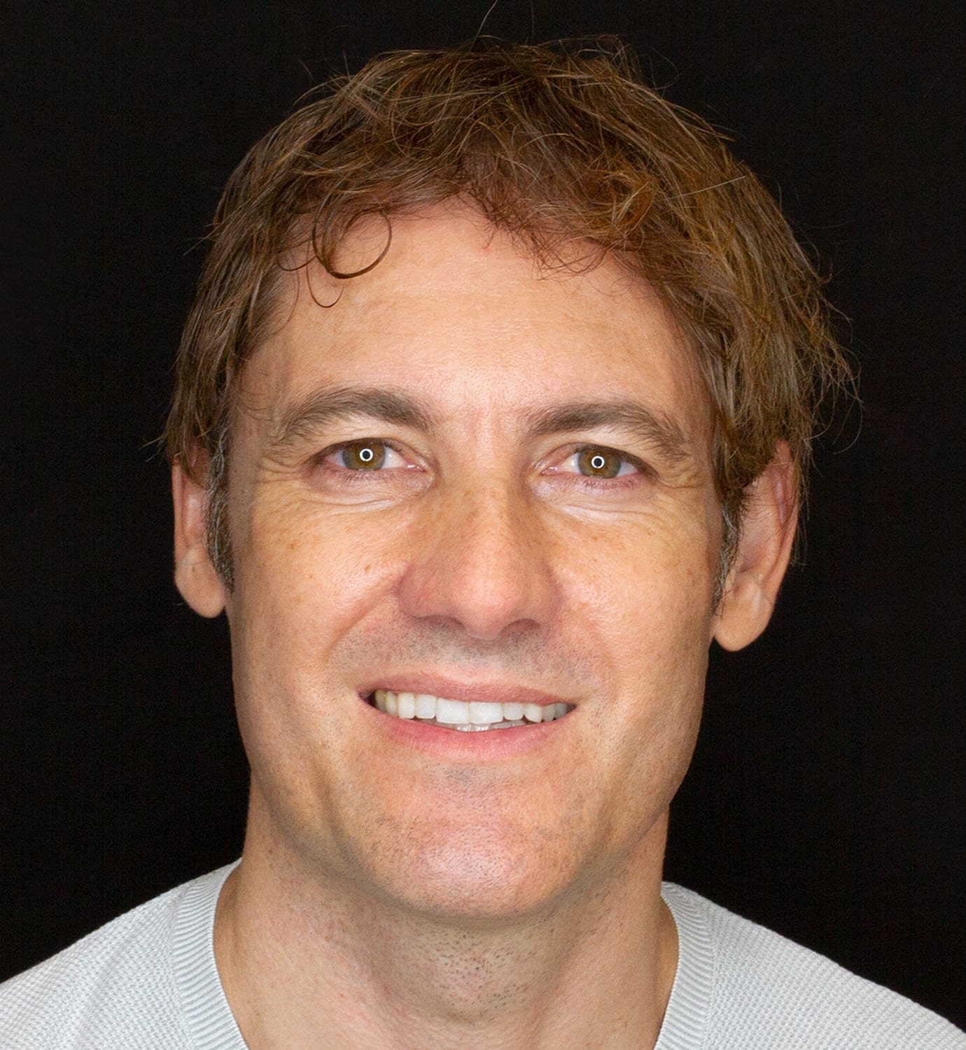 fotografía de después