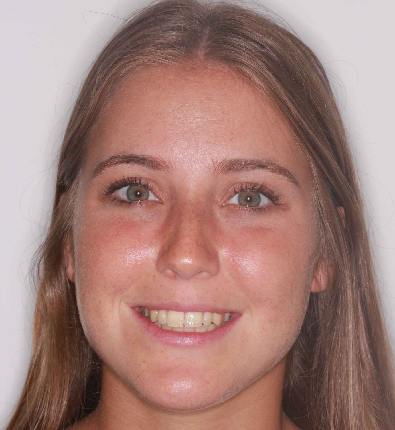 fotografía de antes