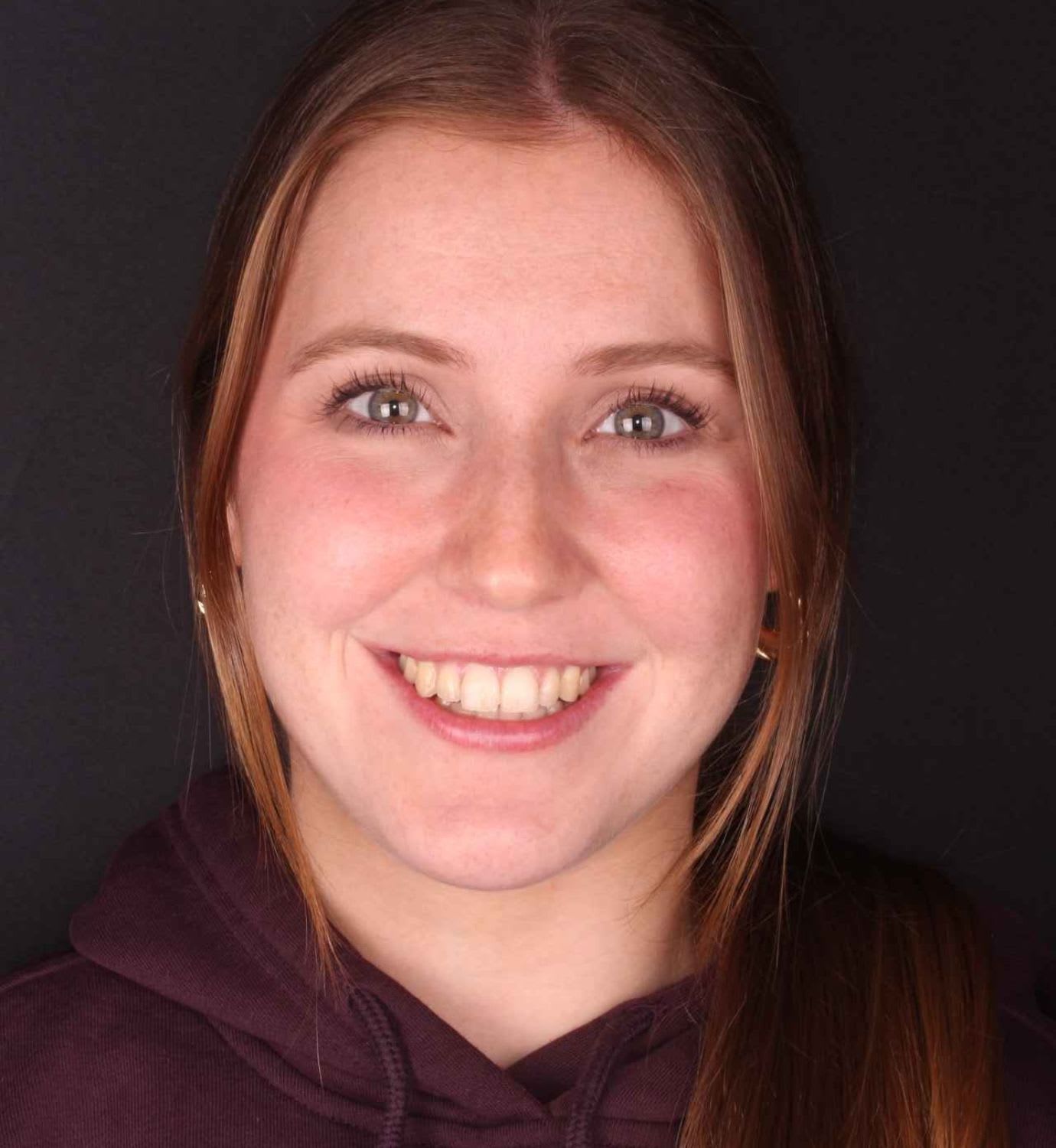 fotografía de después