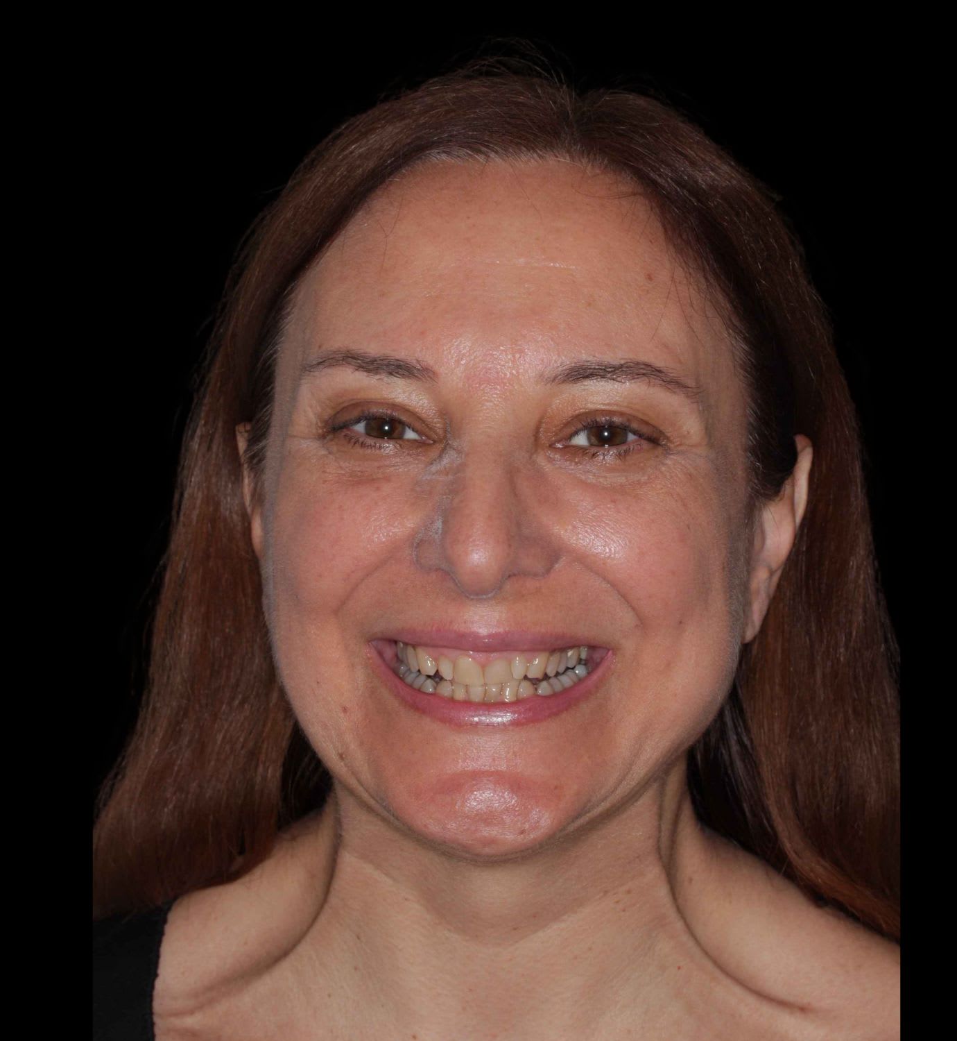 fotografía de antes