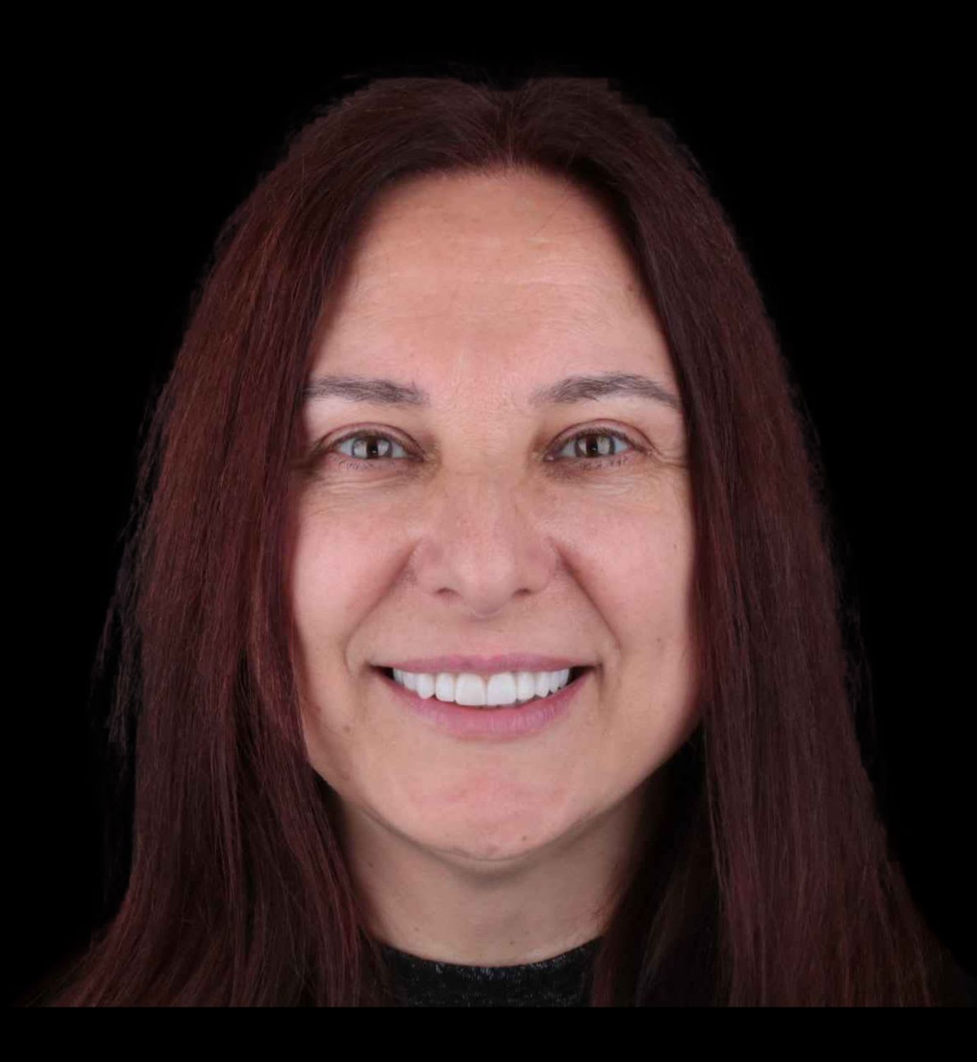 fotografía de después