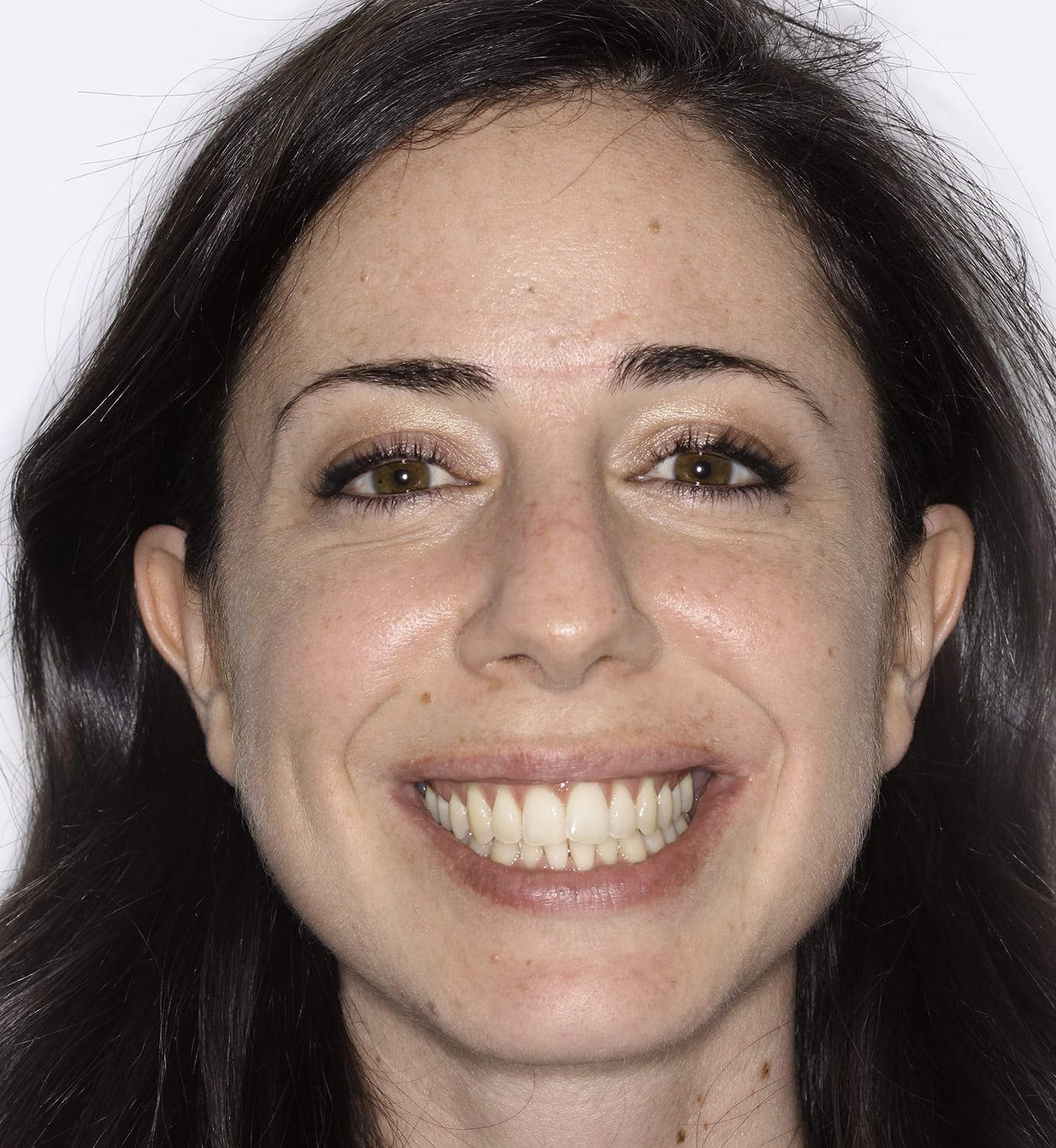 fotografía de antes