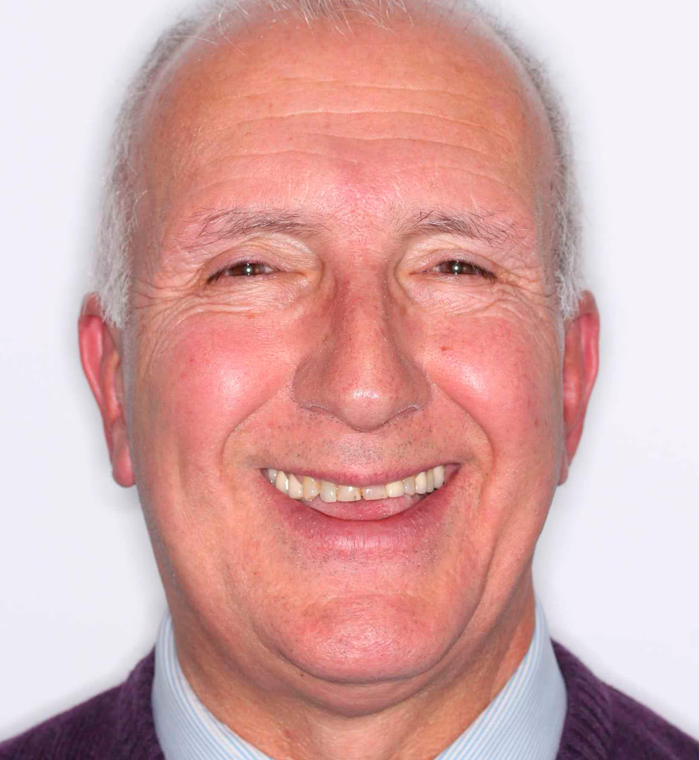 fotografía de antes