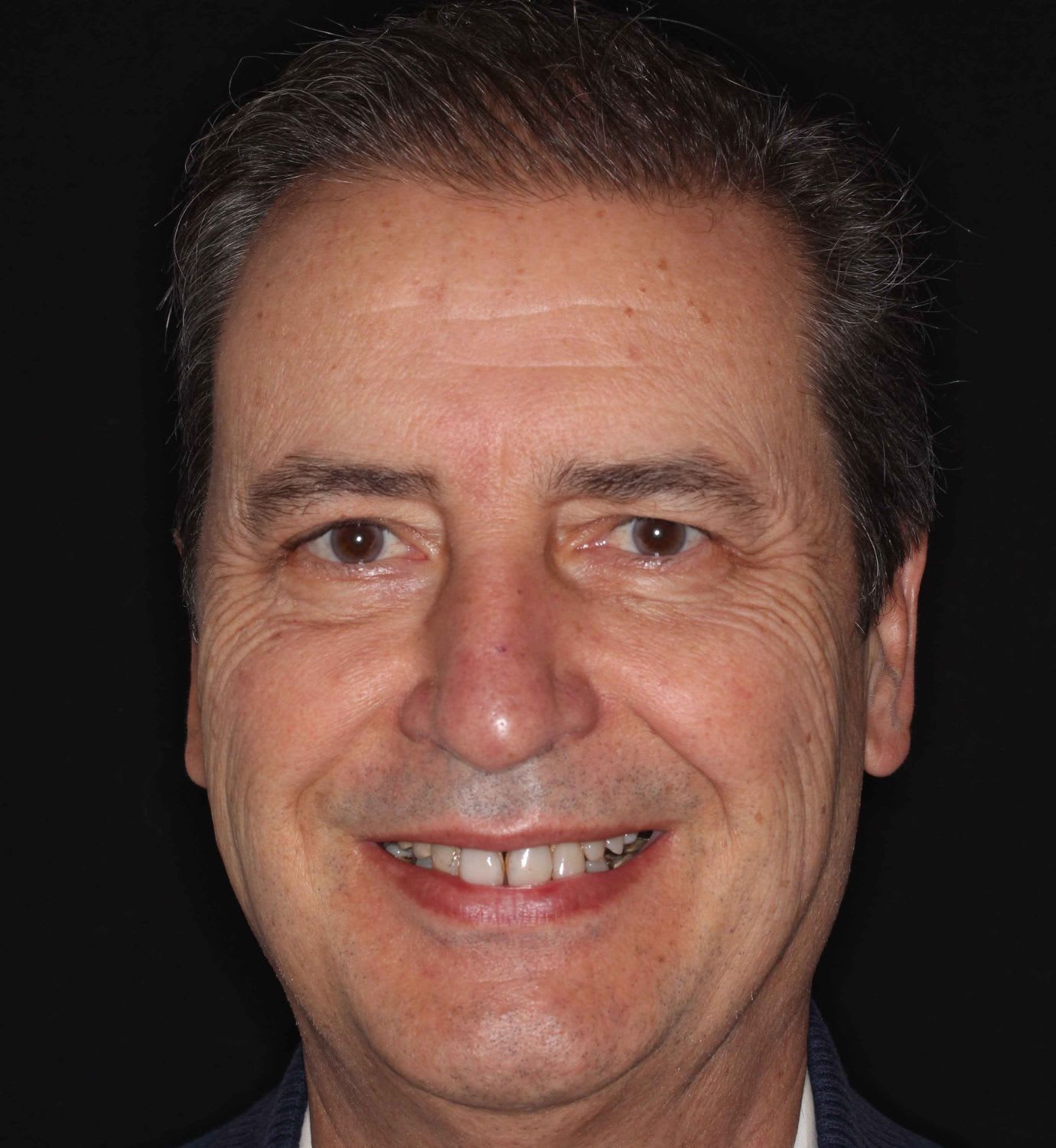 fotografía de antes