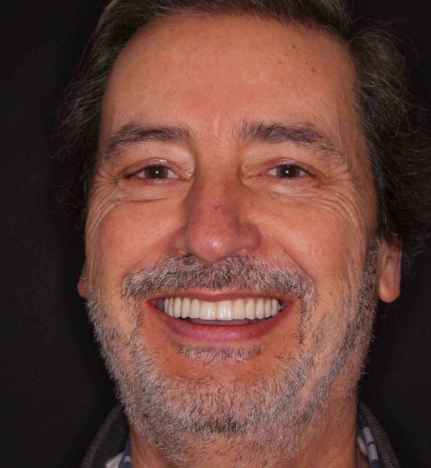 fotografía de después