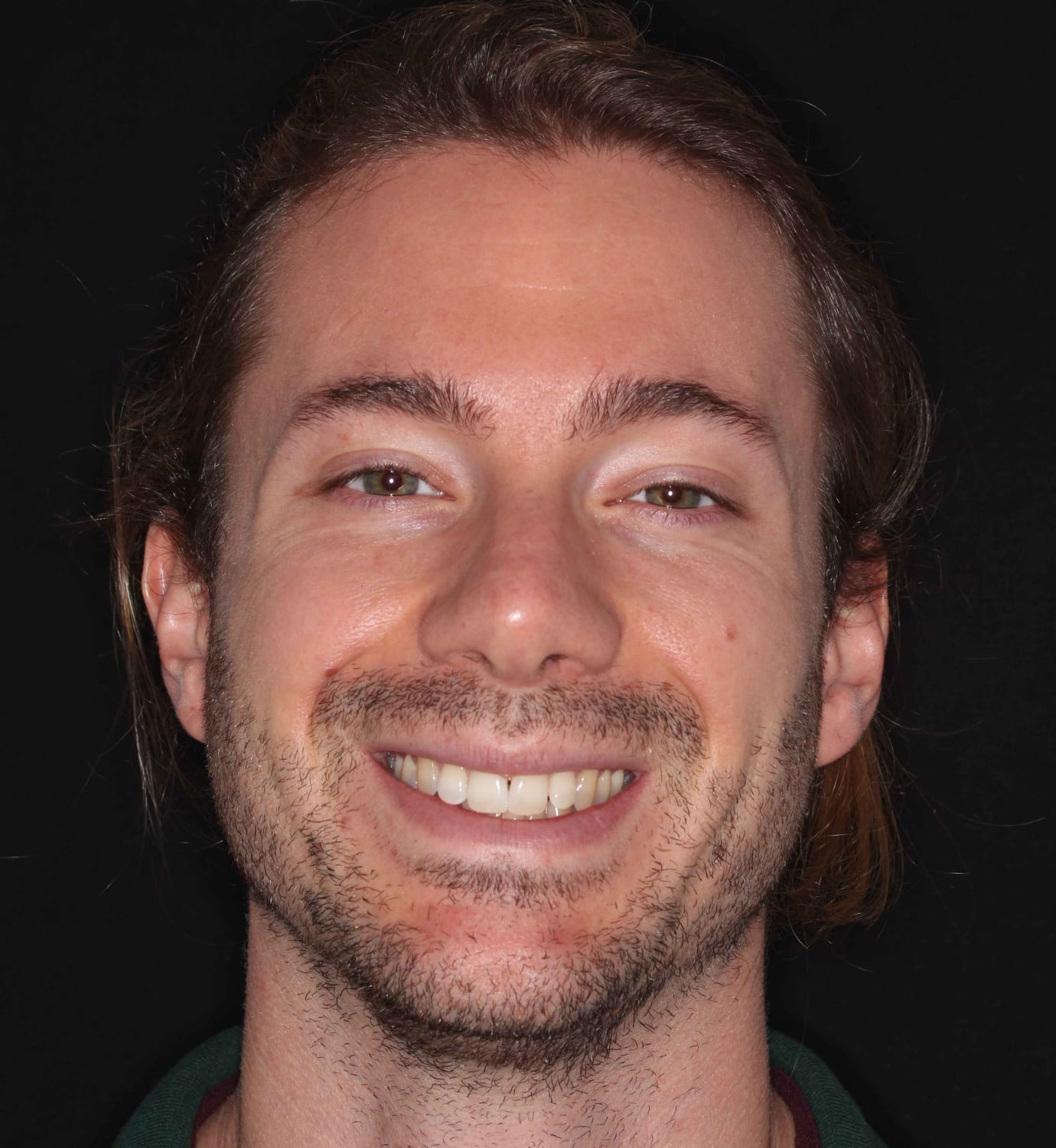 fotografía de antes