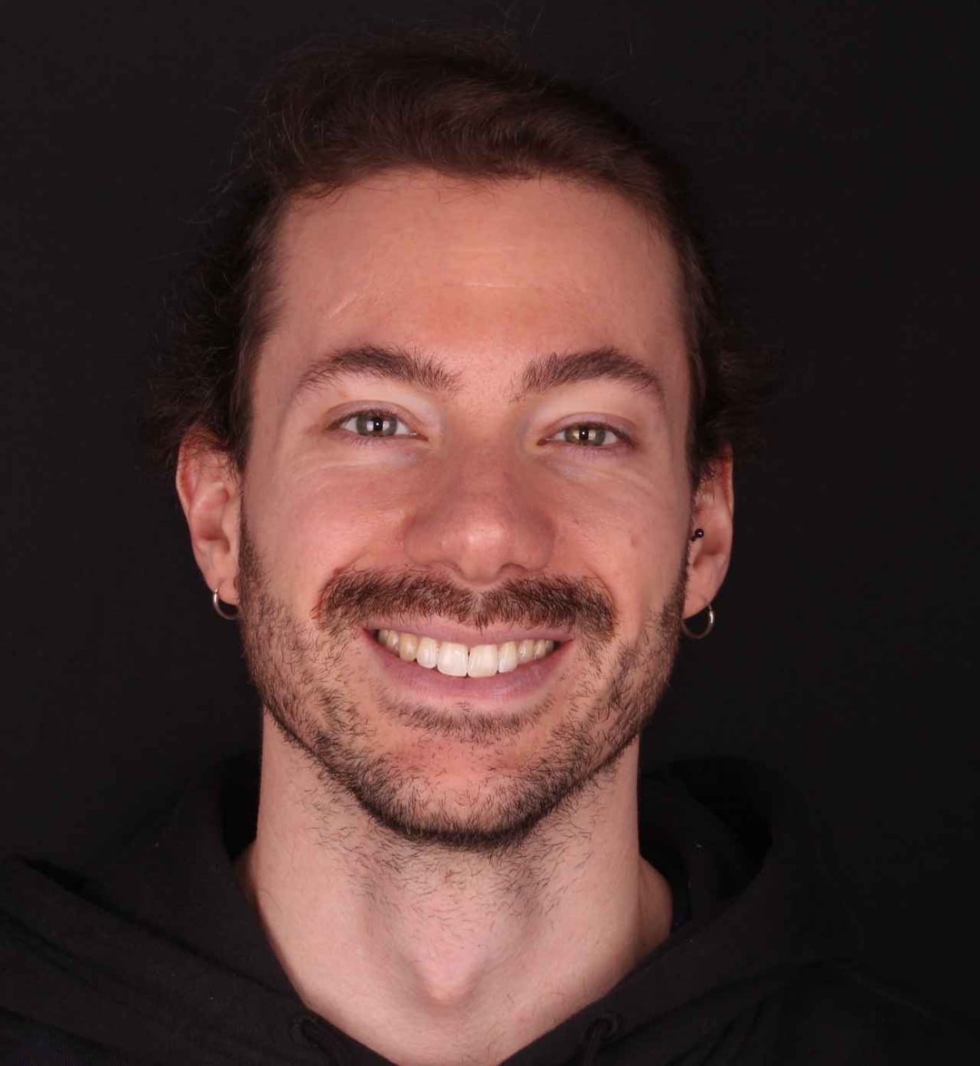 fotografía de después