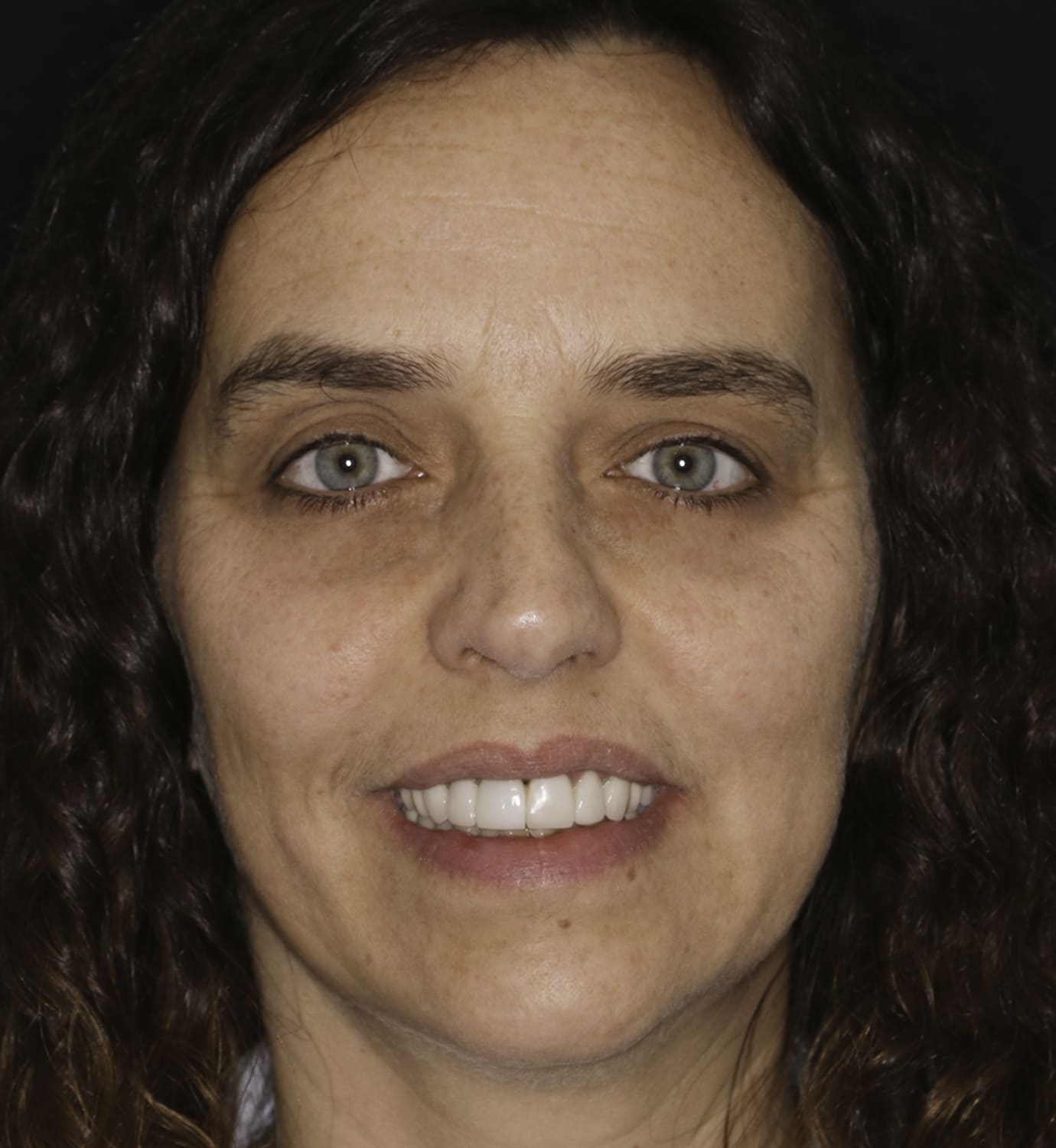 fotografía de después