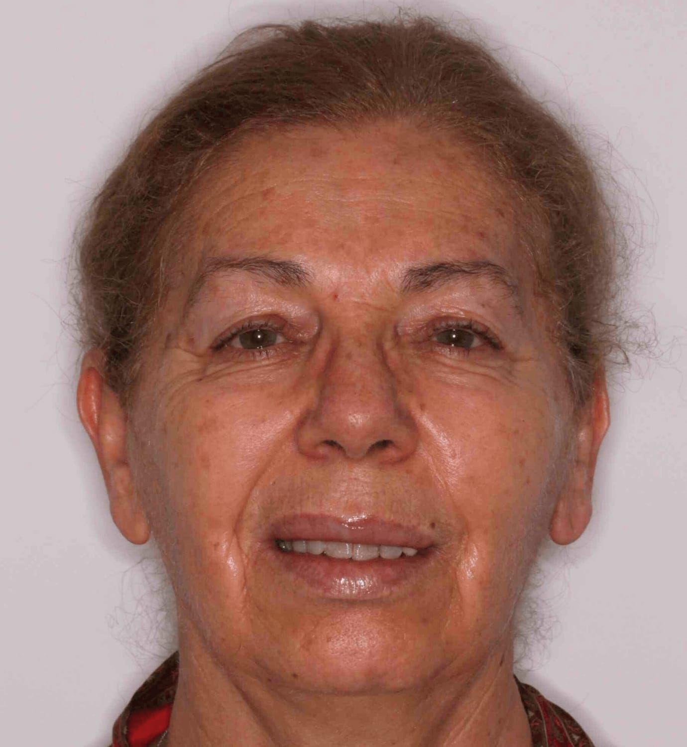 fotografía de antes