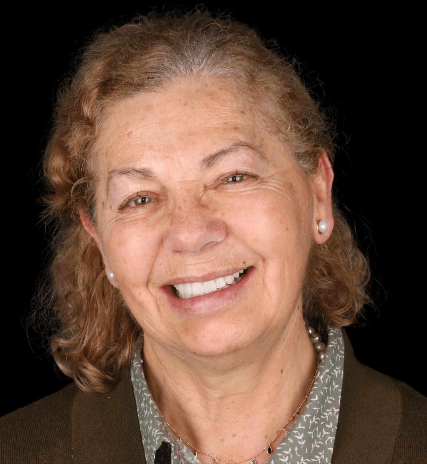 fotografía de después