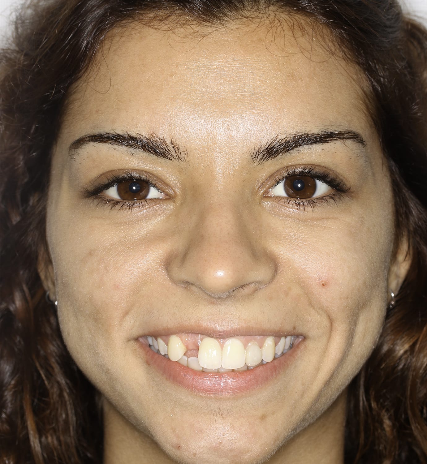 fotografía de antes