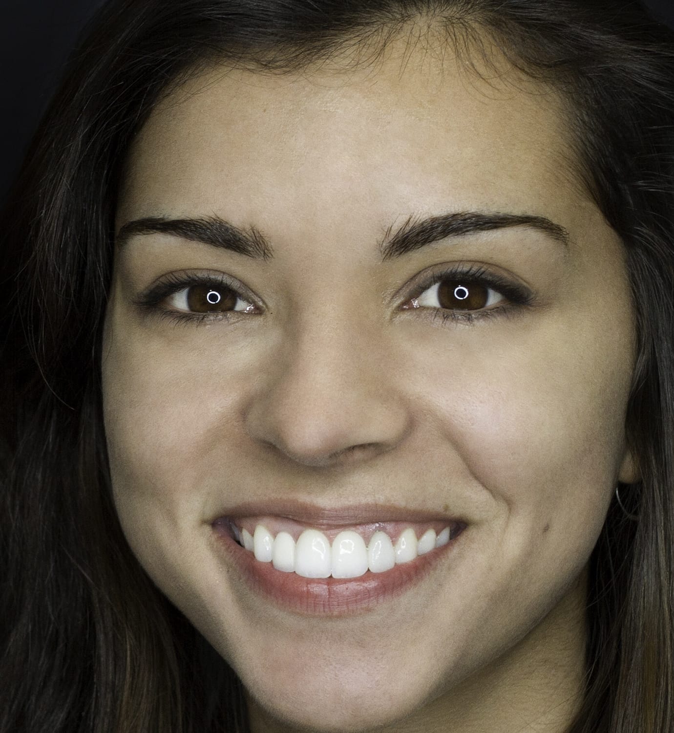 fotografía de después