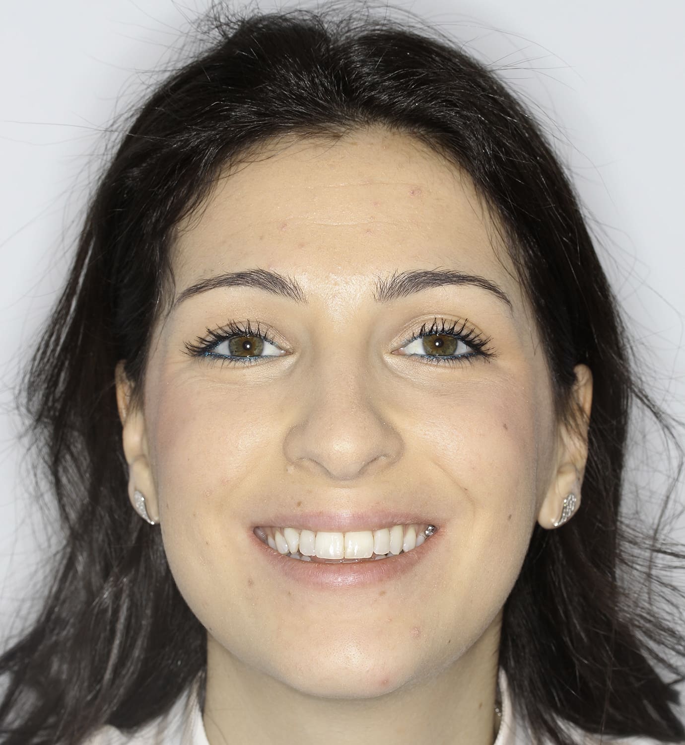 fotografía de antes