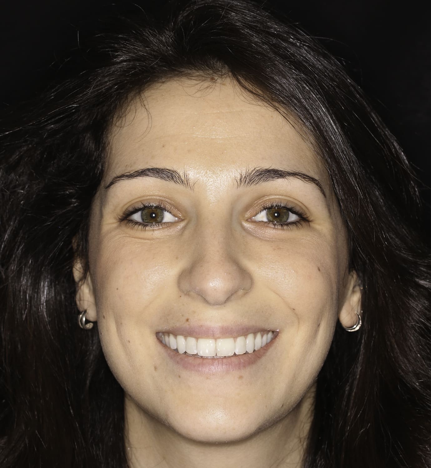 fotografía de después