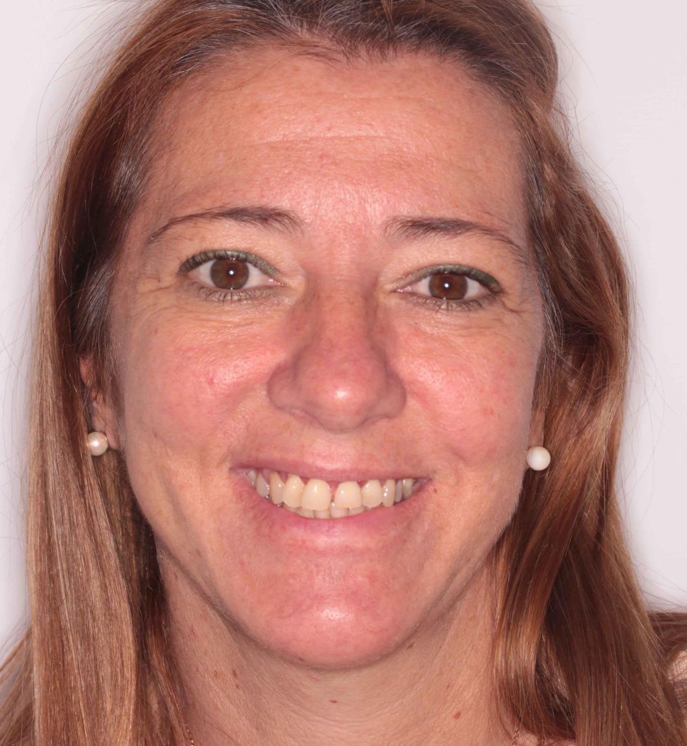 fotografía de antes