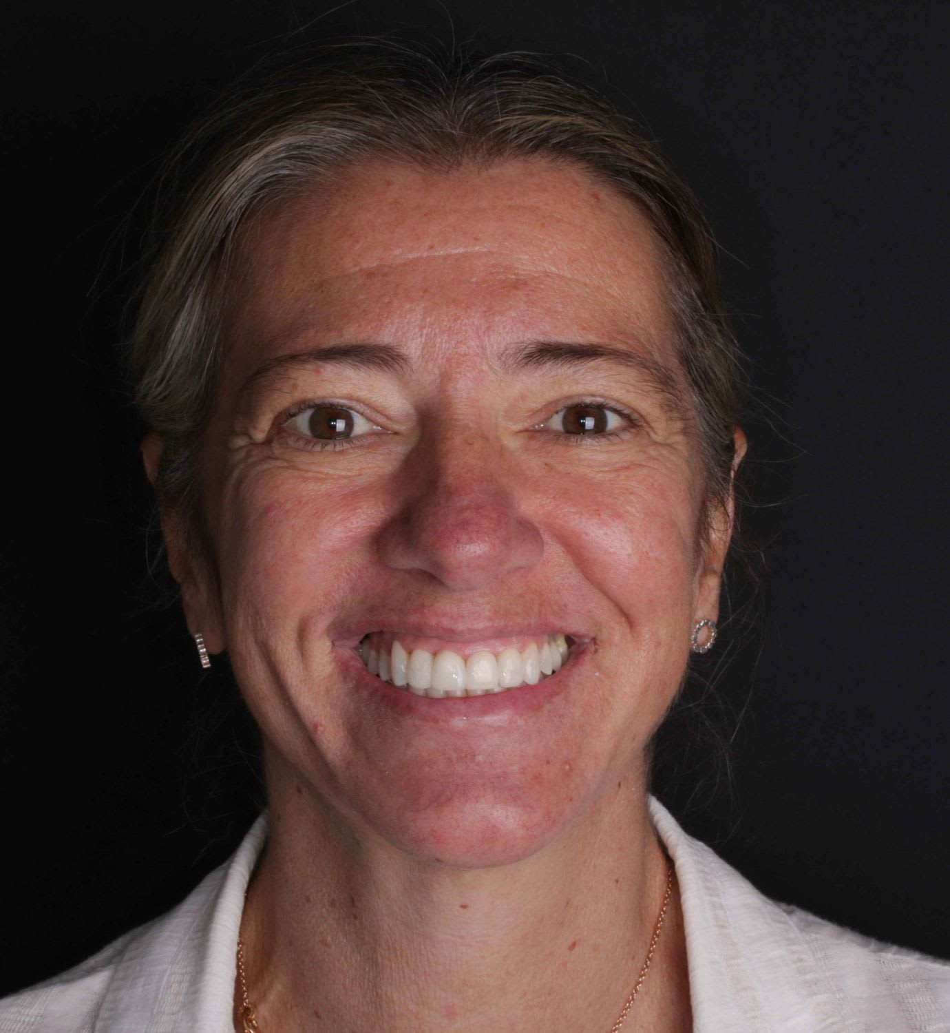 fotografía de después