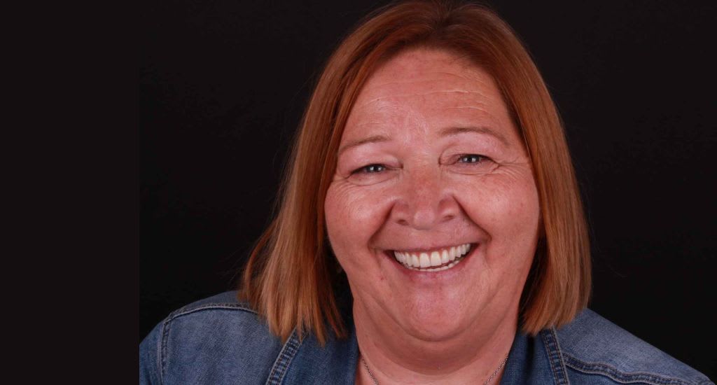 Caso antes y después de sonrisa perfecta con ortodoncia invisible Madrid