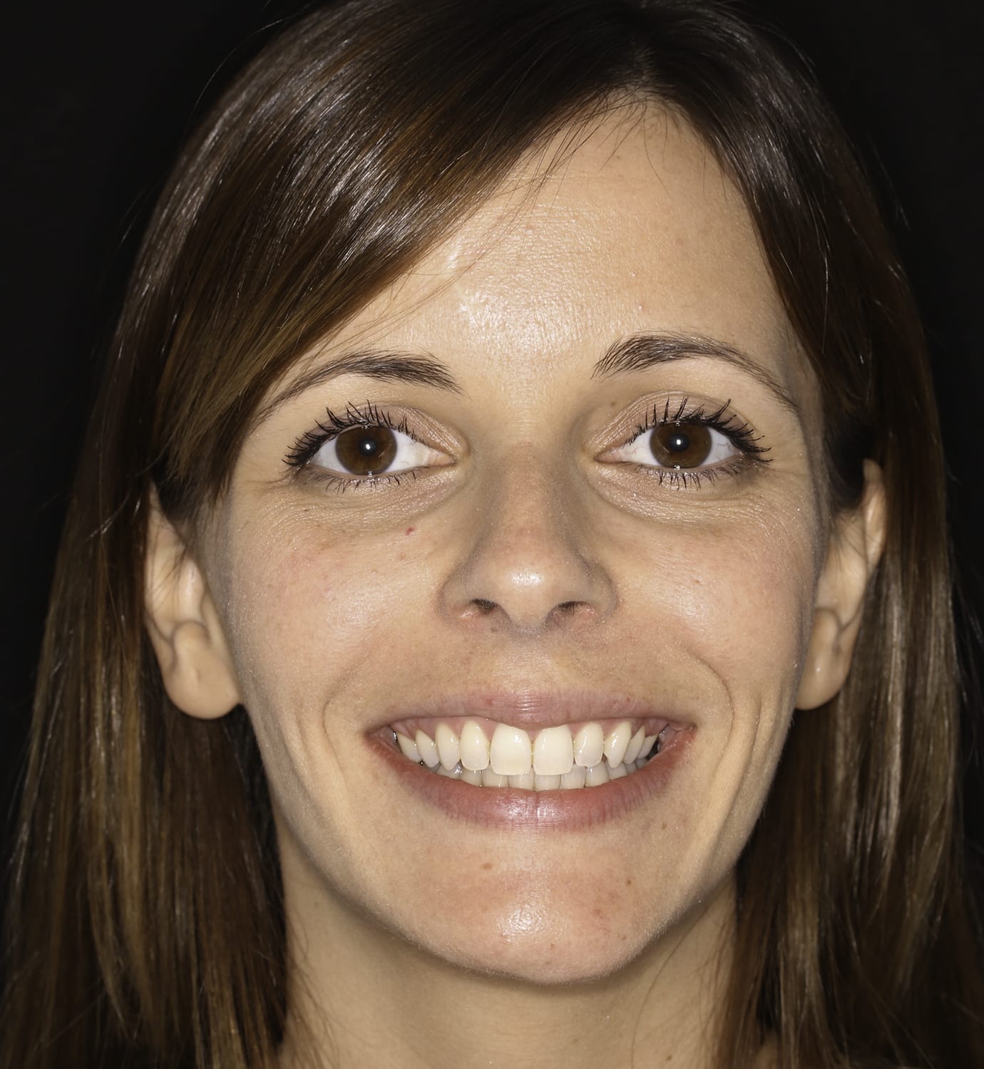 fotografía de después