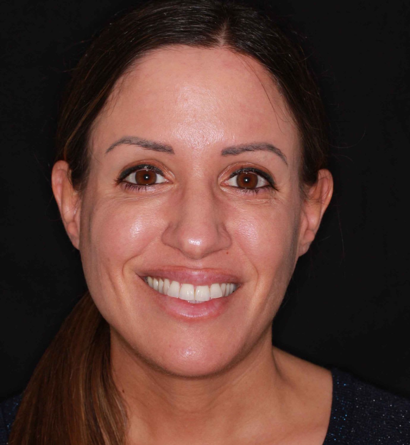 fotografía de antes