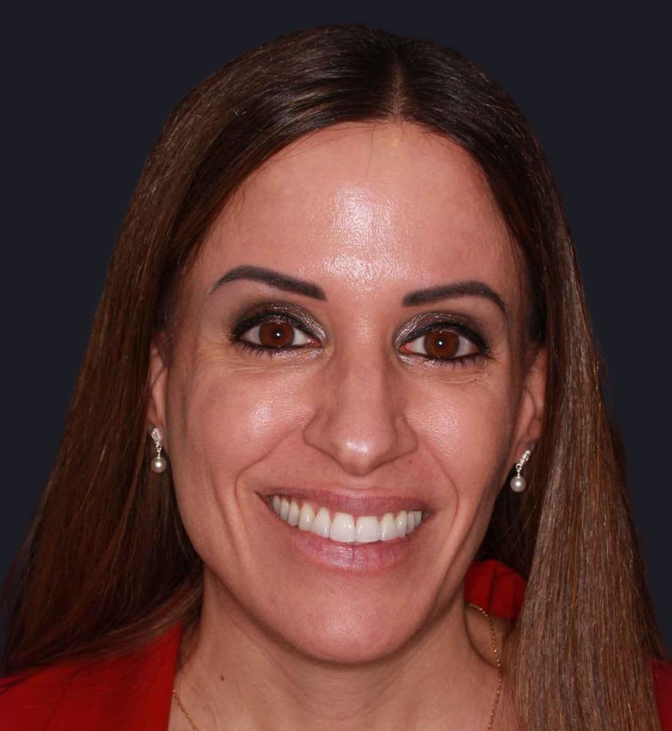 fotografía de después