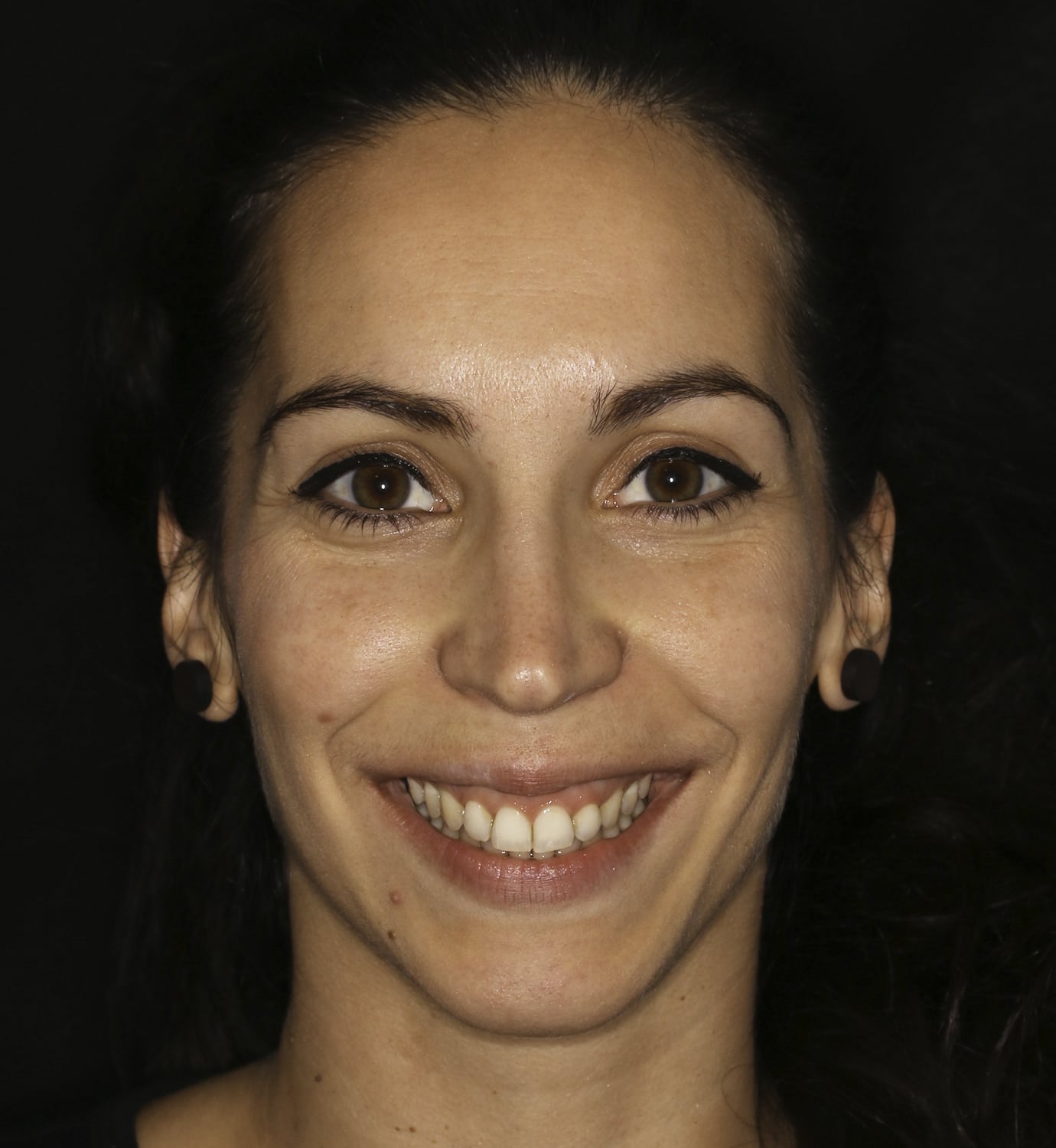 fotografía de después